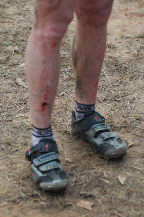 Battle Scars Battle Scars
